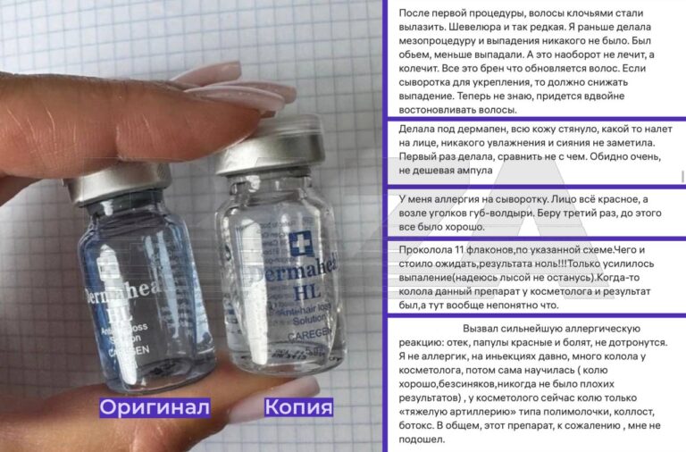 Dermaheal — препарат, который обещает омоложение кожи, но вместо этого оставляет после себя пятна, сыпь, отёки и даже выпадение волос. 💔 Средство активно продаётся в интернете и соцсетях, позиционируясь как «профессиональное». Однако его применение требует инъекций в клиниках, а не домашних экспериментов. Многие девушки, решившие сэкономить на процедурах, столкнулись с серьёзными последствиями: воспалениями, аллергией и повреждениями кожи. По данным «Базы», одной из причин осложнений может быть покупка подделок. Девушки заказывают препарат без сертификации, рискуя здоровьем ради красоты. В итоге многим приходится обращаться к косметологам уже не для омоложения, а чтобы устранить последствия своих ошибок. Мораль: Красота требует не только жертв, но и здравого смысла. 💡. Dermaheal, косметология, здоровье, подделки, красота