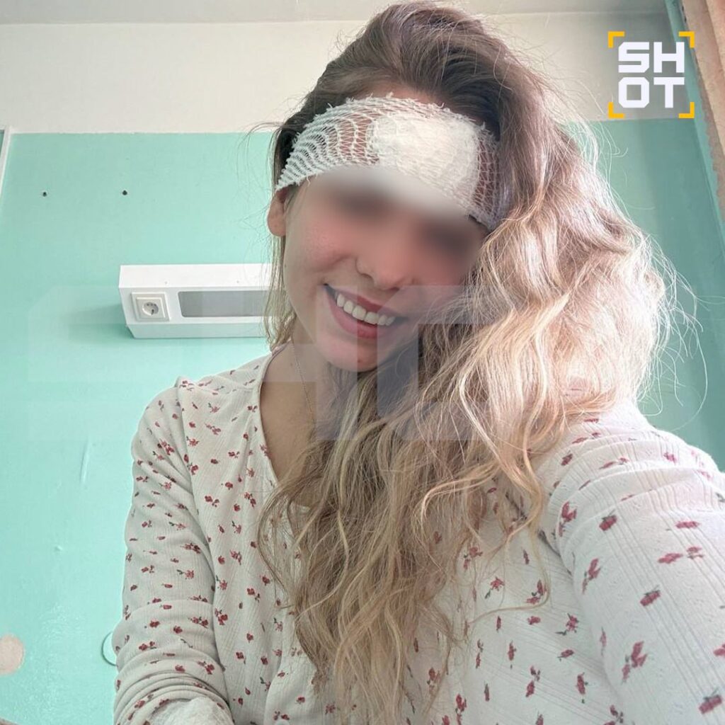 28-летняя Алина из Котласа Архангельской области решила, что справится с прыщом на лбу сама. Но уже на следующий день место, где был прыщ, начало разбухать. Через три дня она обратилась в больницу, где ей посоветовали заклеить рану пластырем. 🤦‍♀️ Через два дня ситуация ухудшилась, и медики экстренно разрезали ей лоб, выписали антибиотики. Однако улучшений не было, и Алину госпитализировали. Врачи объяснили, что такая реакция произошла из-за того, что девушка не обработала руки перед процедурой. В результате образовался гной, а отёк распространился по всему лицу. 🚑 Мораль: не лезьте в своё лицо грязными руками. Или хотя бы обрабатывайте их перед тем, как выдавливать прыщи. Иначе рискуете оказаться на больничной койке. 💉. Здоровье, Котлас, Архангельская область, Госпитализация, Прыщи