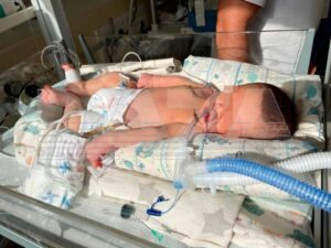 В Петербурге разгорается скандал вокруг роддома № 9. Здесь врачи проигнорировали жалобы роженицы на отслоение плаценты и не провели своевременное кесарево сечение. Результат? Ребёнок перенёс асфиксию, был реанимирован, но получил тяжёлое поражение мозга и стал паллиативным инвалидом. 🚑 Роддом признал факт некачественной медицинской помощи, а правоохранительные органы уже возбудили уголовное дело. Однако это не вернёт здоровье ребёнку и не компенсирует страдания семьи. Ситуация вызывает вопросы о качестве медицинской системы в целом. Сколько ещё таких случаев должно произойти, чтобы система начала работать? 🤔 Подробности читайте в наших источниках: ссылка.. Петербург, Роддом №9, Халатность врачей, Инвалидность, Медицина