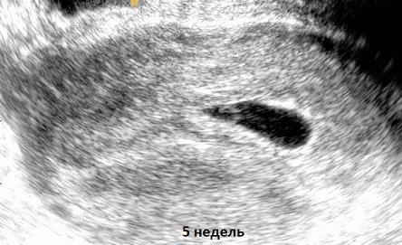 Запрет абортов — это не просто закон, это вопрос выживания. Так считает журналист Анна Шафран, которая в своем канале «Специально для RT» называет искусственное прерывание беременности детоубийством. 🚼 По ее мнению, государство должно сделать этот вопрос приоритетным, если хочет сохранить нацию. Но где грань между защитой жизни и нарушением прав женщин? 🤷‍♀️ Шафран уверена: запрет абортов — это не просто моральный долг, а необходимость для демографического роста. Однако многие эксперты считают, что такой подход приведет к росту подпольных абортов и ухудшению здоровья женщин. 💔 Что важнее: жизнь нерожденных или свобода выбора? Этот вопрос остается открытым, но ясно одно — дискуссия будет жаркой. 🔥. Анна Шафран, запрет абортов, демография, общество, RT