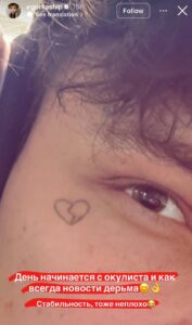 Егор Шип продолжает бороться с ухудшением зрения. На последнем приеме у офтальмолога ему диагностировали третью степень нарушения зрения на правом глазу. Это уже серьезный повод для беспокойства. Сам Шип с присущим ему юмором прокомментировал ситуацию: «Главное, чтоб не потек». Однако шутки в сторону — здоровье глаз требует внимания и своевременного лечения. Пока неизвестно, как это скажется на его карьере и личной жизни. Но одно ясно точно: Егору придется адаптироваться к новым условиям и, возможно, пересмотреть свои привычки. Будем надеяться, что врачи смогут помочь, а Шип сохранит оптимизм. 👁️💪. Егор Шип, здоровье, зрение, медицина, общество