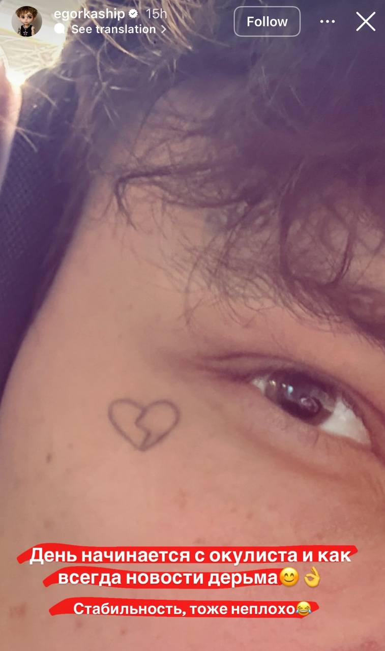 Егор Шип продолжает бороться с ухудшением зрения. На последнем приеме у офтальмолога ему диагностировали третью степень нарушения зрения на правом глазу. Это уже серьезный повод для беспокойства. Сам Шип с присущим ему юмором прокомментировал ситуацию: «Главное, чтоб не потек». Однако шутки в сторону — здоровье глаз требует внимания и своевременного лечения. Пока неизвестно, как это скажется на его карьере и личной жизни. Но одно ясно точно: Егору придется адаптироваться к новым условиям и, возможно, пересмотреть свои привычки. Будем надеяться, что врачи смогут помочь, а Шип сохранит оптимизм. 👁️💪. Егор Шип, здоровье, зрение, медицина, общество