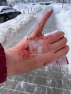 В Москве произошел инцидент с участием одичавшего кота, который напал на двух местных жительниц. Событие произошло во дворе жилого комплекса, где животное уже около года пугало местных жителей. Как сообщается, кот выскочил из-под машины, когда женщины попытались его достать. В результате нападения обе получили множественные царапины и были доставлены в медицинское учреждение для оказания помощи. По данным источника, животное удалось поймать, и сейчас оно находится в ветеринарной клинике. Пострадавшие после оказания медицинской помощи продолжают амбулаторное лечение. Инцидент вызвал широкий резонанс среди жителей района, которые неоднократно жаловались на поведение кота.. Москва, происшествия, одичавший кот, нападение, ветеринарная клиника