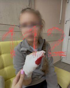 В Бийске ребенок получил тяжелую травму в детском саду. Бийск, детский сад, травма, ампутация, происшествия