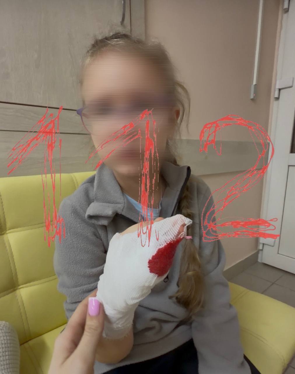 В Бийске ребенок получил тяжелую травму в детском саду. Бийск, детский сад, травма, ампутация, происшествия