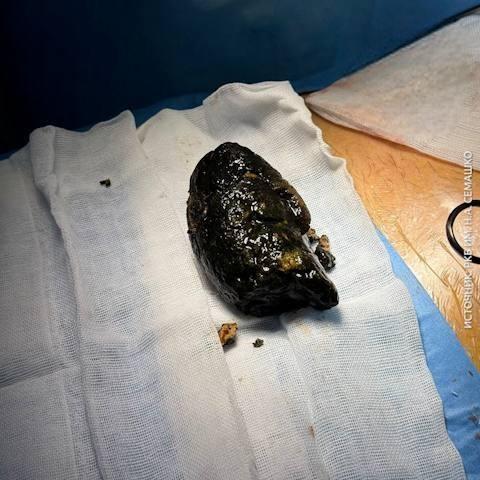 Хурма и молоко: опасный дуэт, который чуть не убил жителя Улан-Удэ 🚨. Улан-Удэ, хурма, молоко, фитобезоар, здоровье