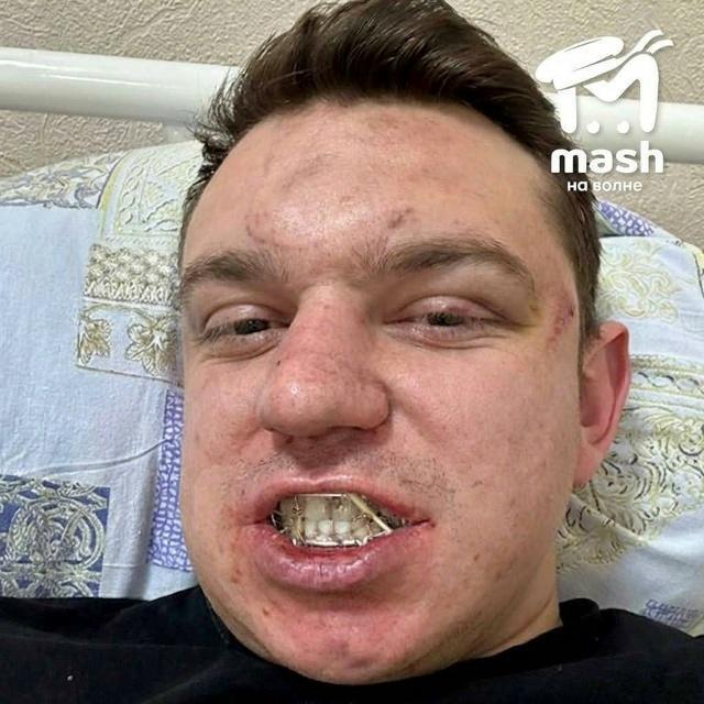 Официант избит гостями кафе в Симферополе. Симферополь, кафе Бай 888, избиение, происшествия, криминал