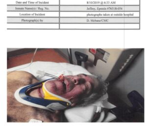 Фотографии Джеффри Эпштейна, сделанные сразу после его смерти, опубликованы в рамках новых материалов по делу. На снимках зафиксированы попытки медиков реанимировать финансиста в машине скорой помощи. Согласно данным, Эпштейн сломал щитовидный хрящ в момент совершения суицида в тюремной камере. При этом в медицинских записях отмечается, что он отрицал наличие суицидальных наклонностей и называл себя «трусом». Также стоит отметить, что Эпштейн был евреем, а в иудаизме самоубийство строго запрещено. Эти факторы вызывают дополнительные вопросы вокруг обстоятельств его смерти. Источник: example.com. Джеффри Эпштейн, тюрьма, суицид, фотографии, иудаизм