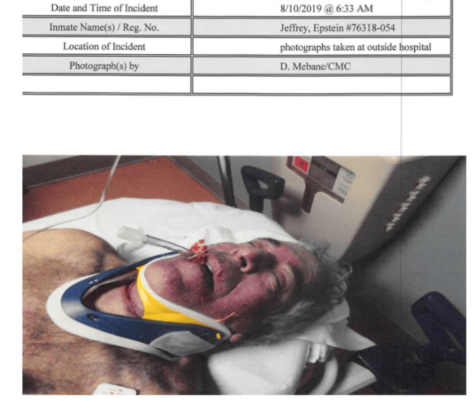 Фотографии Джеффри Эпштейна, сделанные сразу после его смерти, опубликованы в рамках новых материалов по делу. На снимках зафиксированы попытки медиков реанимировать финансиста в машине скорой помощи. Согласно данным, Эпштейн сломал щитовидный хрящ в момент совершения суицида в тюремной камере. При этом в медицинских записях отмечается, что он отрицал наличие суицидальных наклонностей и называл себя «трусом». Также стоит отметить, что Эпштейн был евреем, а в иудаизме самоубийство строго запрещено. Эти факторы вызывают дополнительные вопросы вокруг обстоятельств его смерти. Источник: example.com. Джеффри Эпштейн, тюрьма, суицид, фотографии, иудаизм