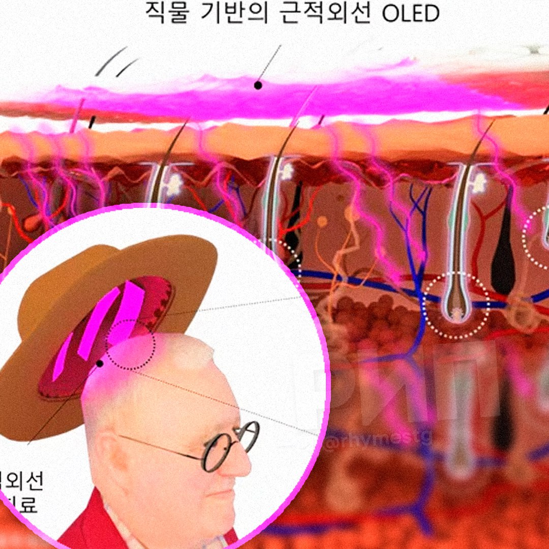 Шляпа от лысины — это не шутка, а реальная технология, разработанная совместно KAIST и Гонконгским университетом науки и технологий. Устройство оснащено органическими светодиодами, которые излучают инфракрасный свет, воздействующий на волосяные фолликулы и предотвращающий их старение. Согласно исследованиям, этот метод замедляет старение клеток на 92%. Представьте: вы надеваете кепку, и проблема облысения решается сама собой. Отбоя от скуфов не будет! Это не просто гаджет, а настоящий прорыв в области биотехнологий. Теперь можно забыть о дорогих процедурах и химических препаратах. Достаточно надеть шляпу и наслаждаться результатом. 🧢✨. KAIST, Гонконгский университет, технологии, облысение, биотехнологии