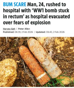 Во Франции произошёл необычный инцидент, связанный с обнаружением артиллерийского снаряда времен Первой мировой войны в теле пациента. 24-летний мужчина обратился в больницу с жалобами на сильную боль. Результаты рентгеновского обследования показали наличие 20-сантиметрового боеприпаса в его прямой кишке. Медикам пришлось экстренно эвакуировать пациентов и персонал, вызвать сапёров, а также оцепить прилегающую территорию. Пожарные службы были переведены в режим повышенной готовности. Теперь мужчине предстоит объяснить полиции, как и где он нашёл снаряд, а также причины его помещения внутрь тела. Это уже не первый подобный случай во Франции. В 2022 году в Тулоне аналогичный инцидент произошёл с 88-летним мужчиной. Власти продолжают расследование обстоятельств происшествия.. Франция, Происшествия, Медицина, Артиллерийский снаряд, Тулоне