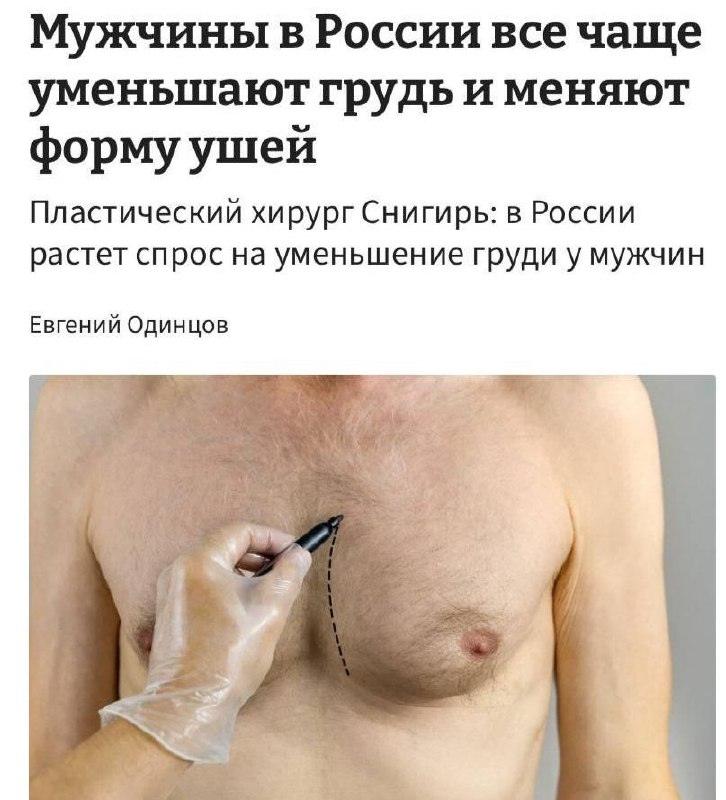 Мужчины в России массово идут под нож: пластика на пике популярности 🪒. пластическая хирургия, мужчины, Россия, здоровье, тренды