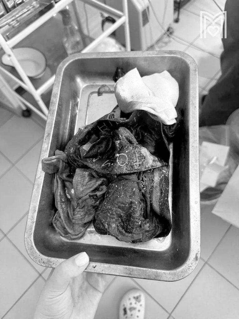 Бордоский дог проглотил белье: спасение питомца