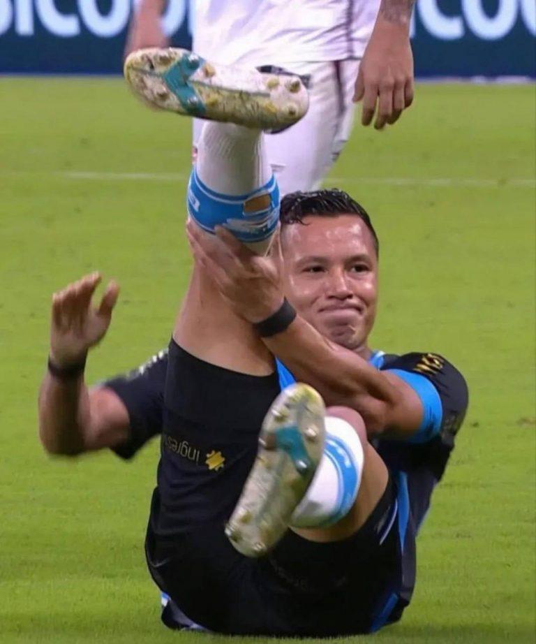 Марлон сломал лодыжку в матче против Витории: шокирующий момент