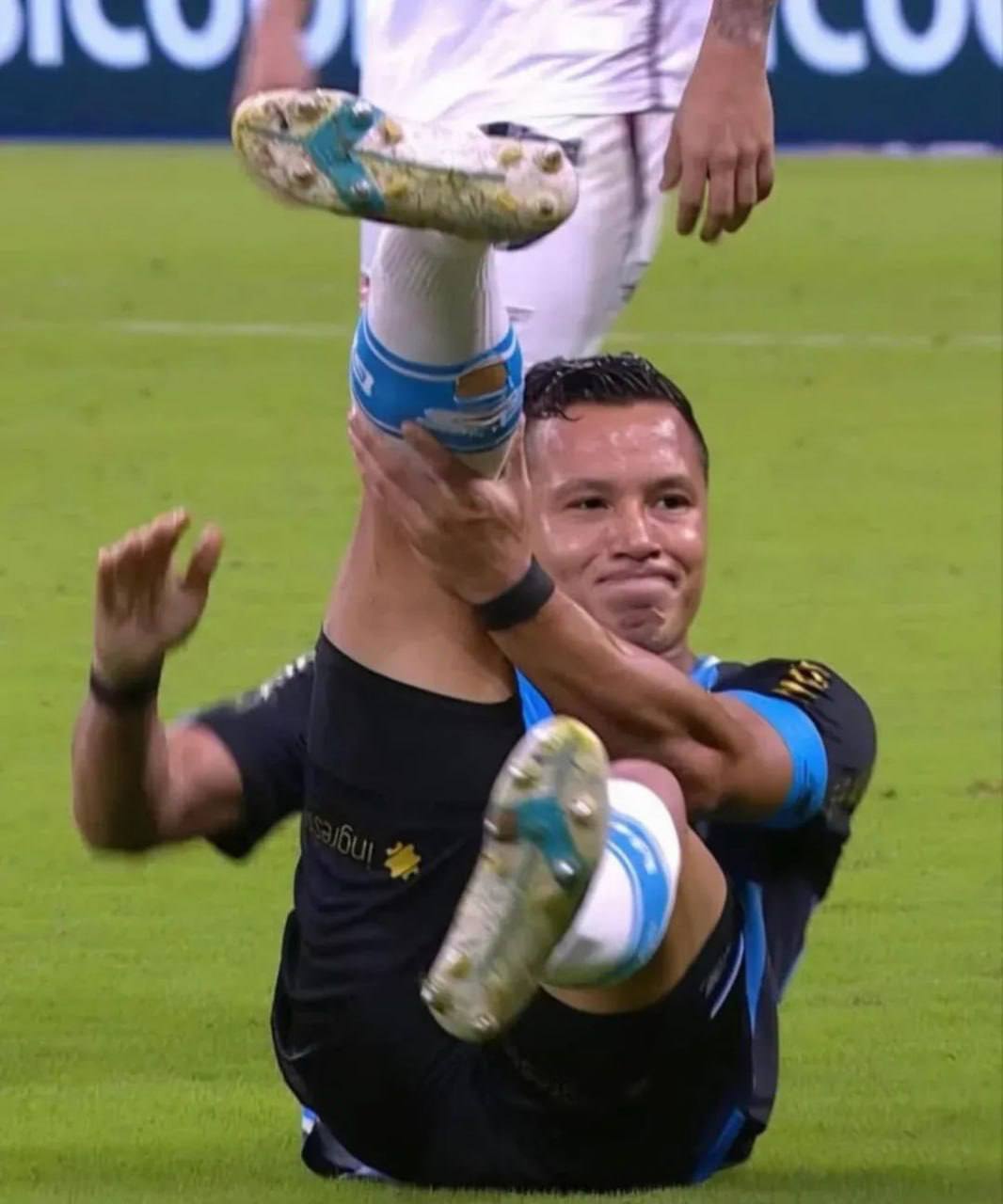 Марлон сломал лодыжку в матче против Витории: шокирующий момент