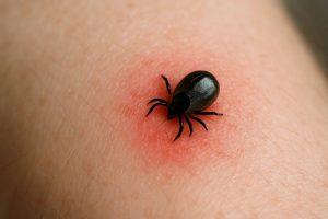 Сезон клещей в Подмосковье: как защититься от укусов