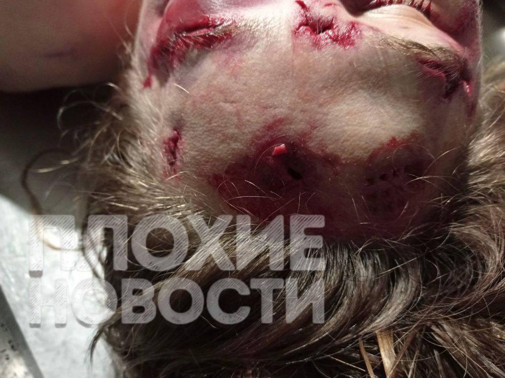Конфликт на Украине: мужчина зарезал беременную возлюбленную 💔🔪 — на украине мужчина зарезал беременную возлюбленную