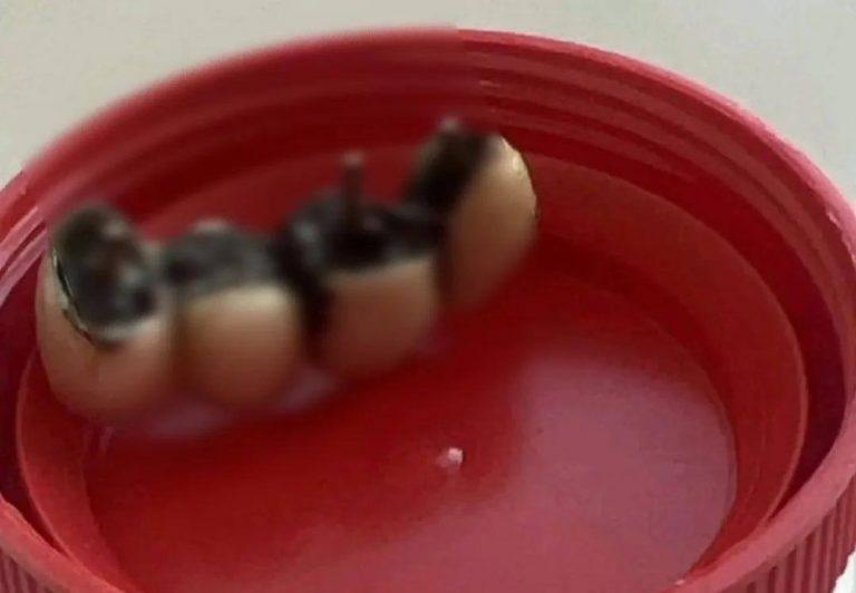 Хирурги спасли мужчину с протезом в легких 🦷🫁 — приморец пять лет жил с зубным протезом в легком