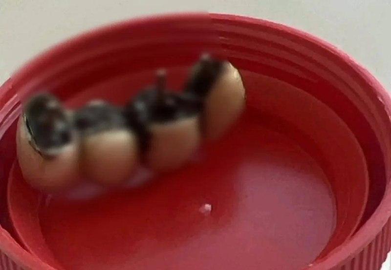 Хирурги спасли мужчину с протезом в легких 🦷🫁 — приморец пять лет жил с зубным протезом в легком