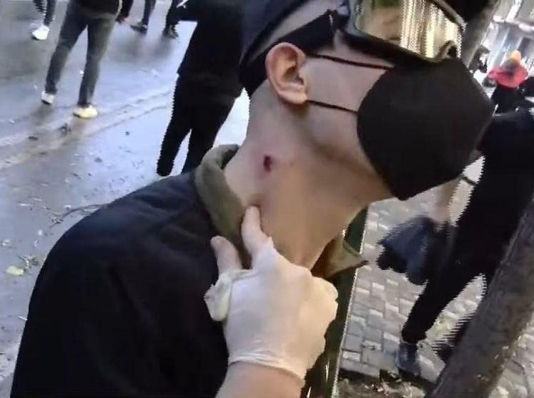 Полиция Албании пустила газ и пули в митингующих 🔥🚨 — протесты в албании сегодня